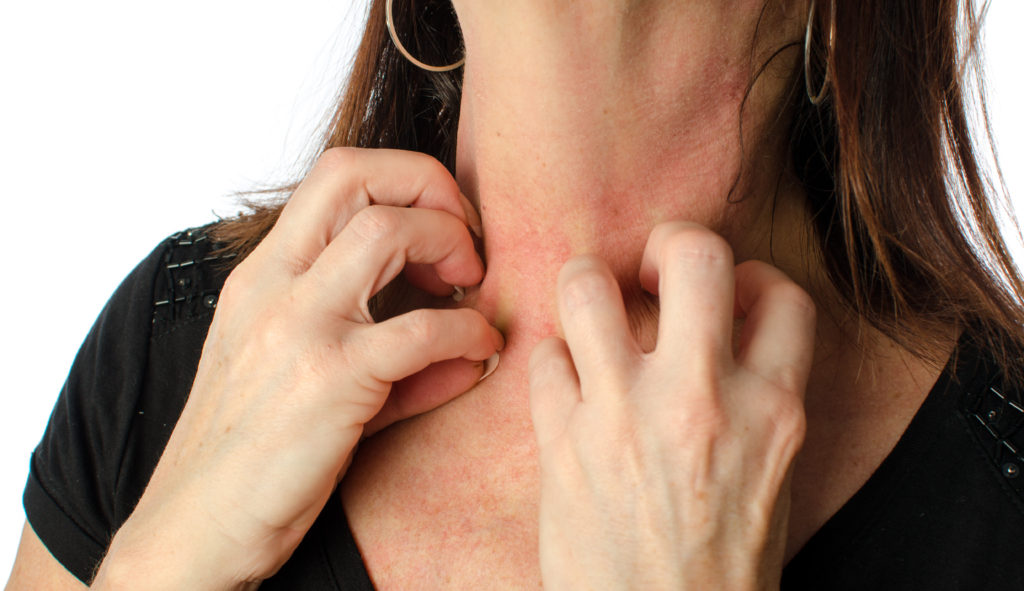アトピー性皮膚炎の症状が悪化しやすい部位＆悪化する理由とは？