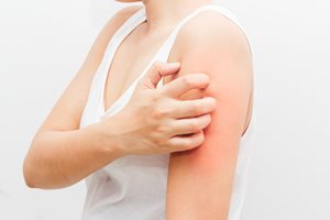 冬になると肌がかゆくなる原因は? かゆみ肌を防ぐ方法
