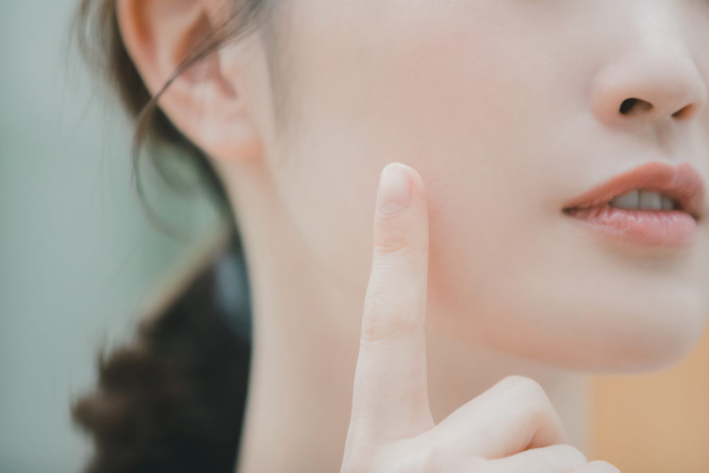 しつこい大人ニキビには○○がいい!? 原因と対策とは