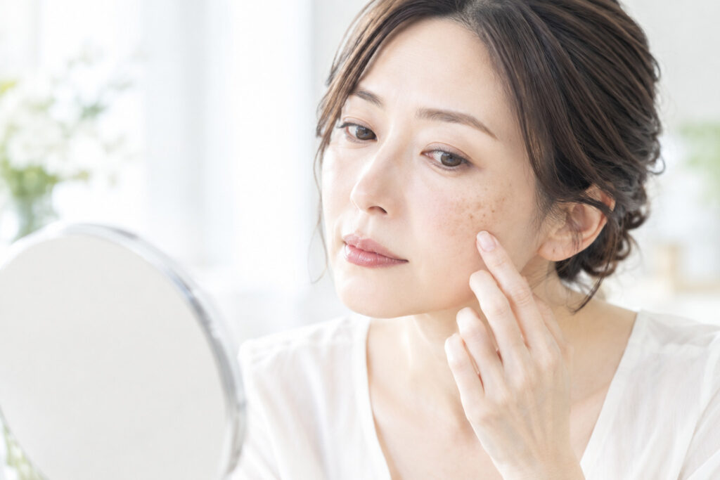 シミ治療を美容皮膚科で受けるには｜美容皮膚科クリニックが教える、種類別の治療の考え方
